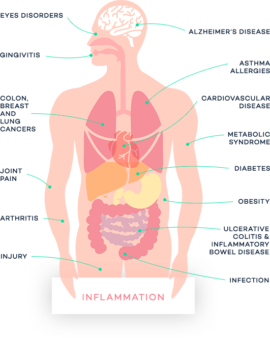 Image of Human Showing All the Disorders Inflammation Causes and Effects