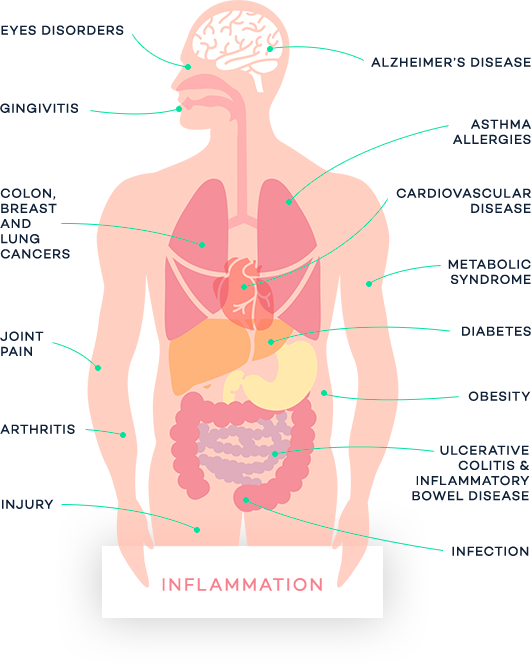 Image of Human Showing All the Disorders Inflammation Causes and Effects