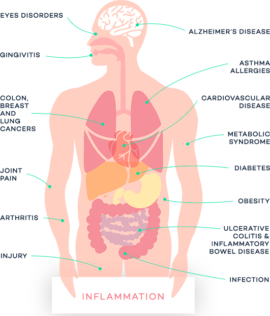 Image of Human Showing All the Disorders Inflammation Causes and Effects
