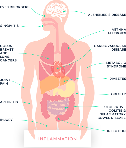 Image of Human Showing All the Disorders Inflammation Causes and Effects