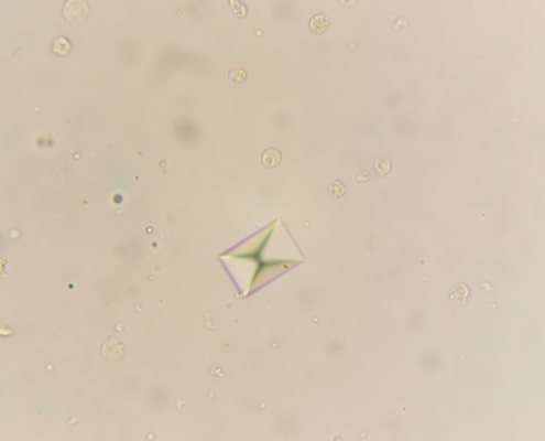 Calcium oxalate