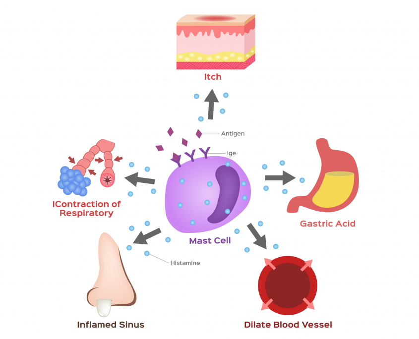 HIstamine intolerance