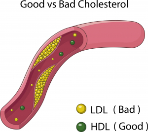Good and bad cholesterol