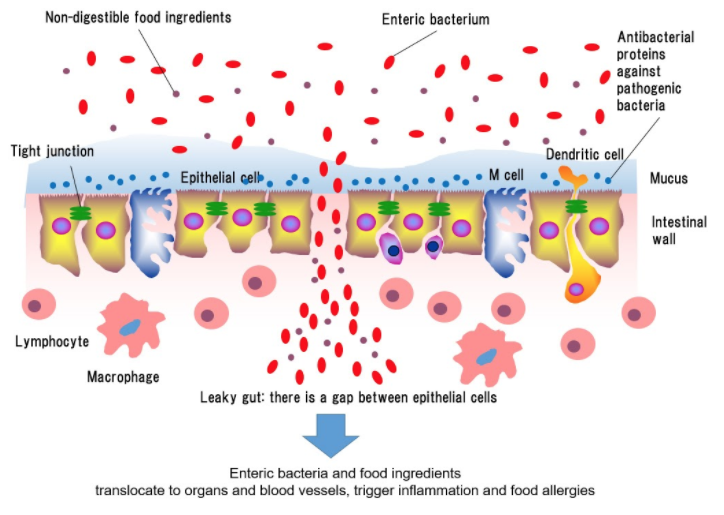 Gluten & Gut Health