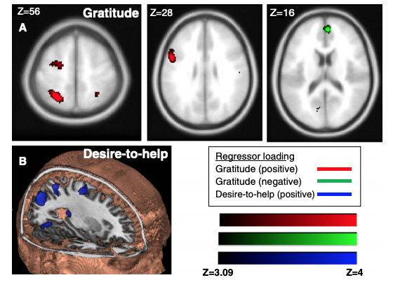 Neuroscience of gratitude