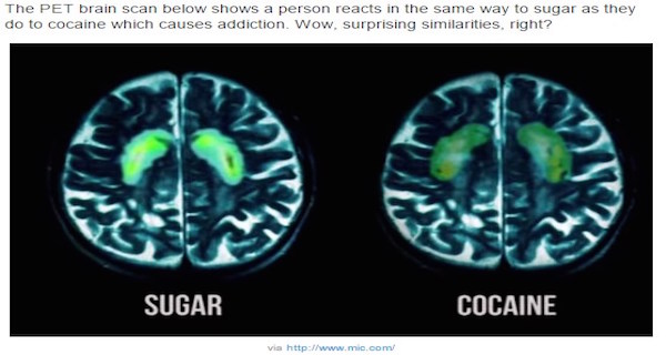 Sugar on the brain