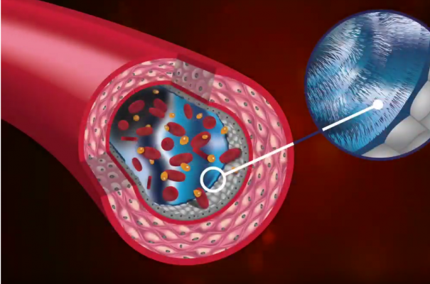 The importance of glycocalyx