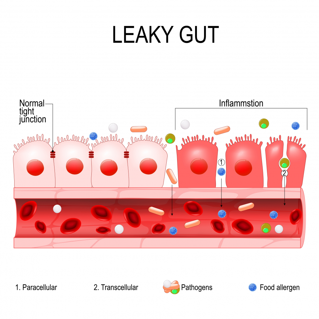 leaky gut. cells on gut lining held tightly together. in intestine with celiac disease and gluten sensitivity these tight junctions come apart. autoimmune disorder. Vector diagram for educational, medical, biological and science use