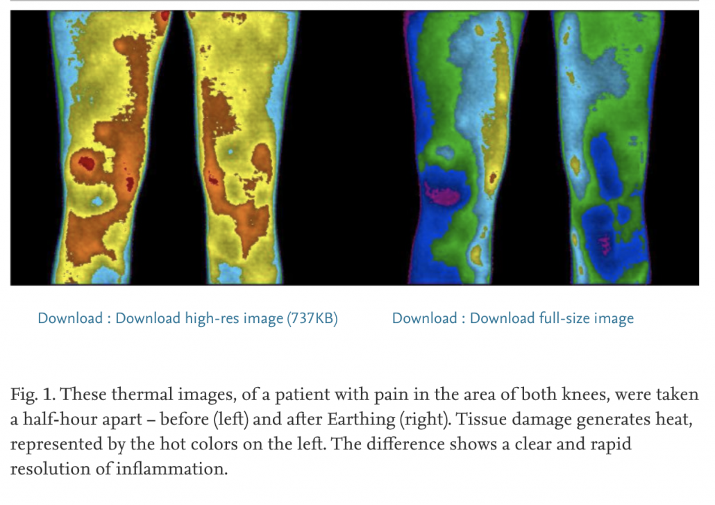 heat imaging showing decreased inflammation after grounding