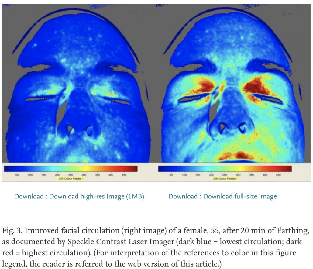 heat imaging showing blood flow increased to face after grrounding