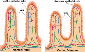 diagram of intestinal permeability due to lectins