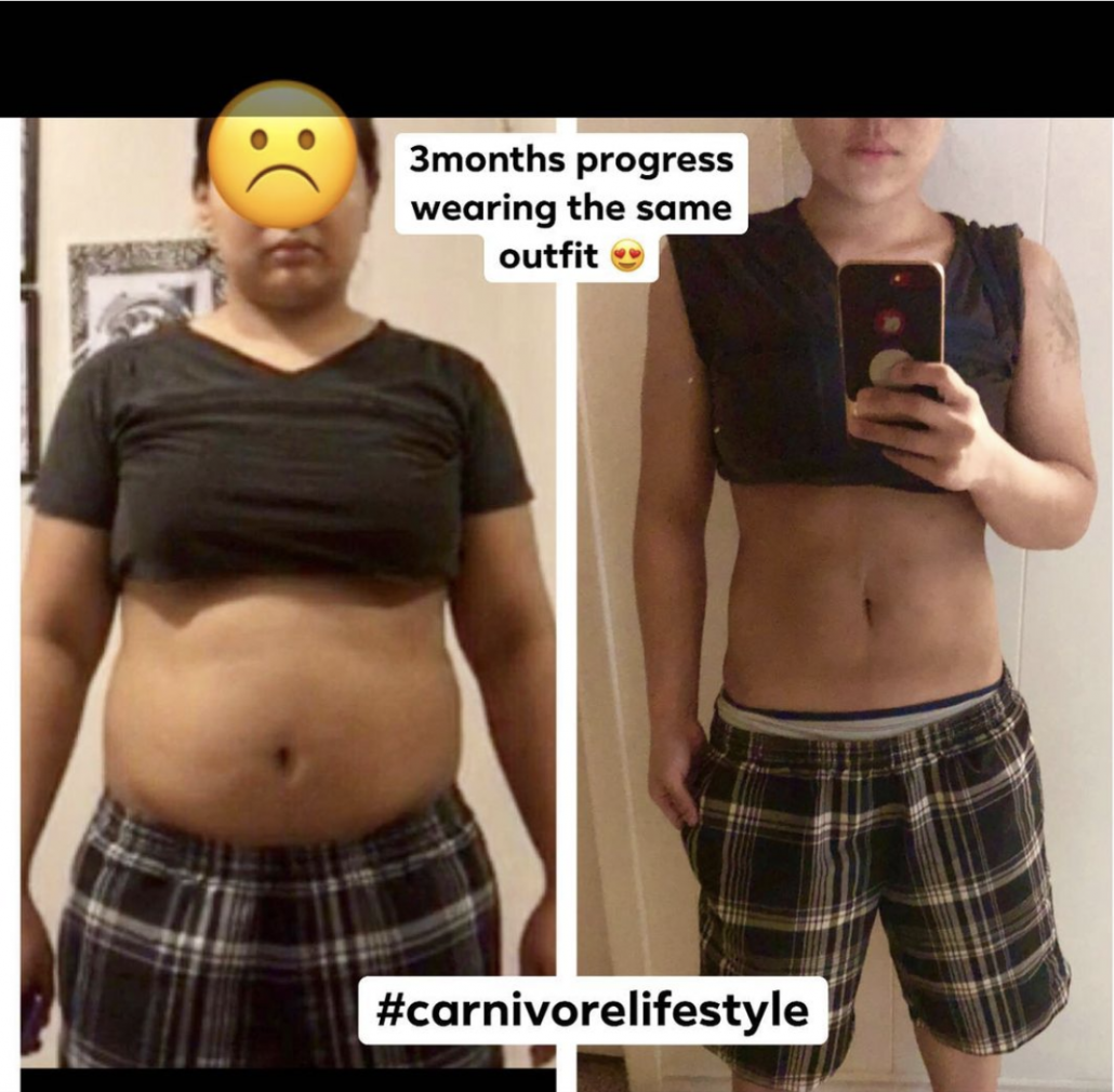 Carnivore Diet Results: Before and After Pictures - Dr. Robert Kiltz