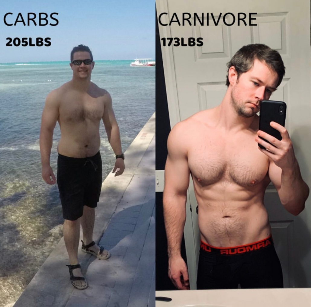 nathan carnivore diet before and after pictures