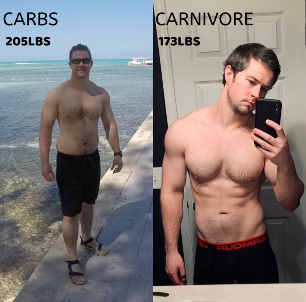 Carnivore Diet Before and After Photos: 5 Success Stories Over 50