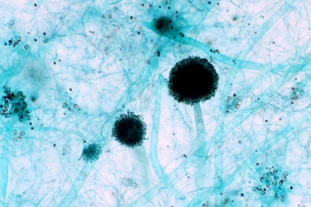 Aspergillus (mold) under the light microscopic view for microbiology education.