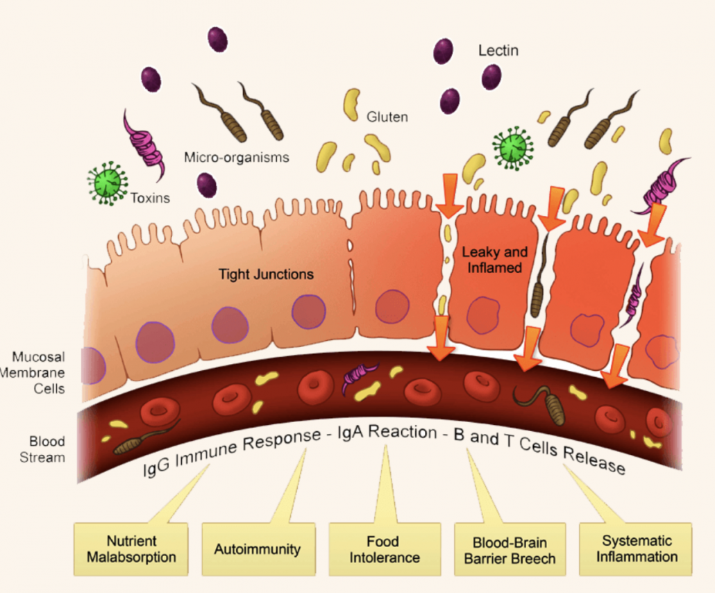 diagram of antigens attacking the gut lining
