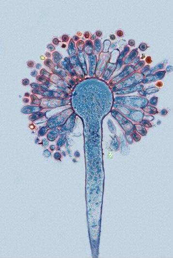 electron microscope image of an aflatoxin spore