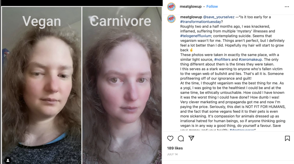 before and after carnivore diet image and story