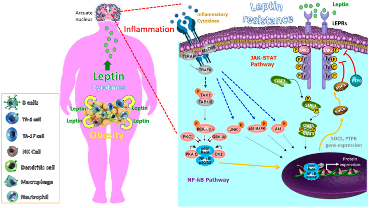 image of leptin resistance caused by inflammation in hypothalamus