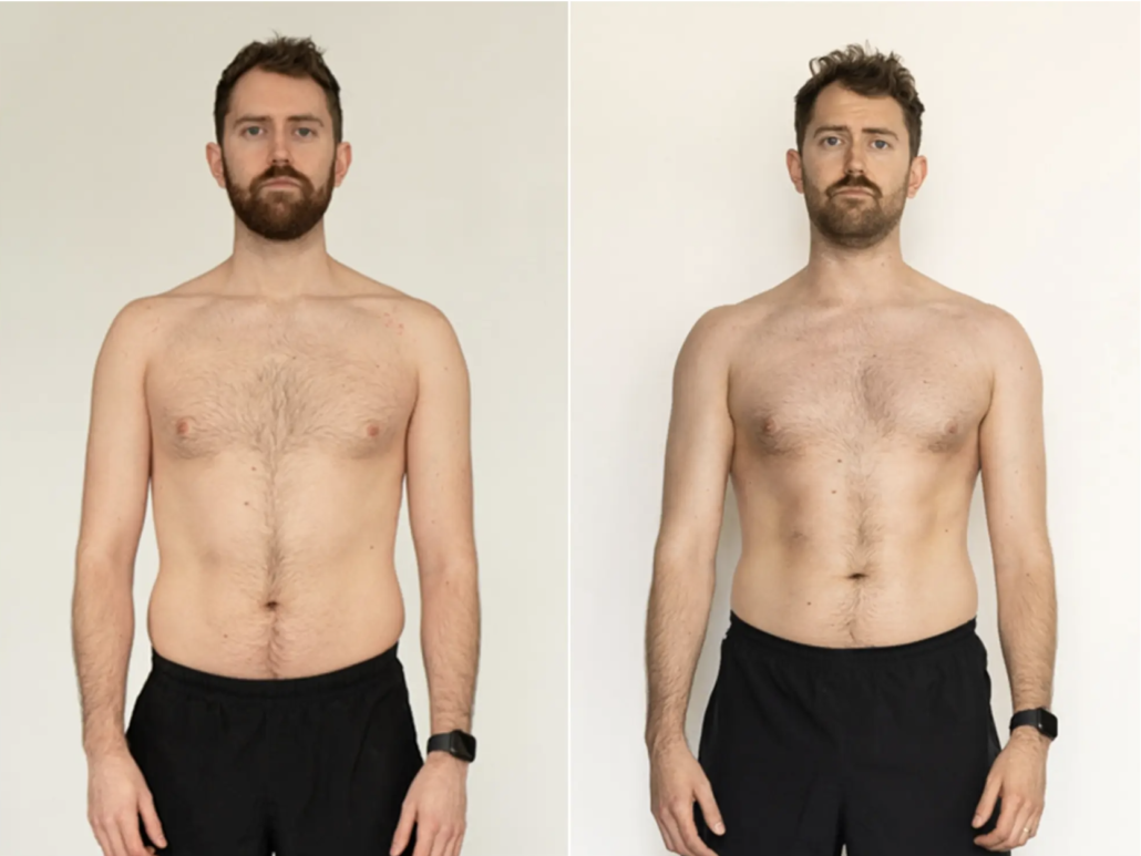 before and after pics intermittent fasting results