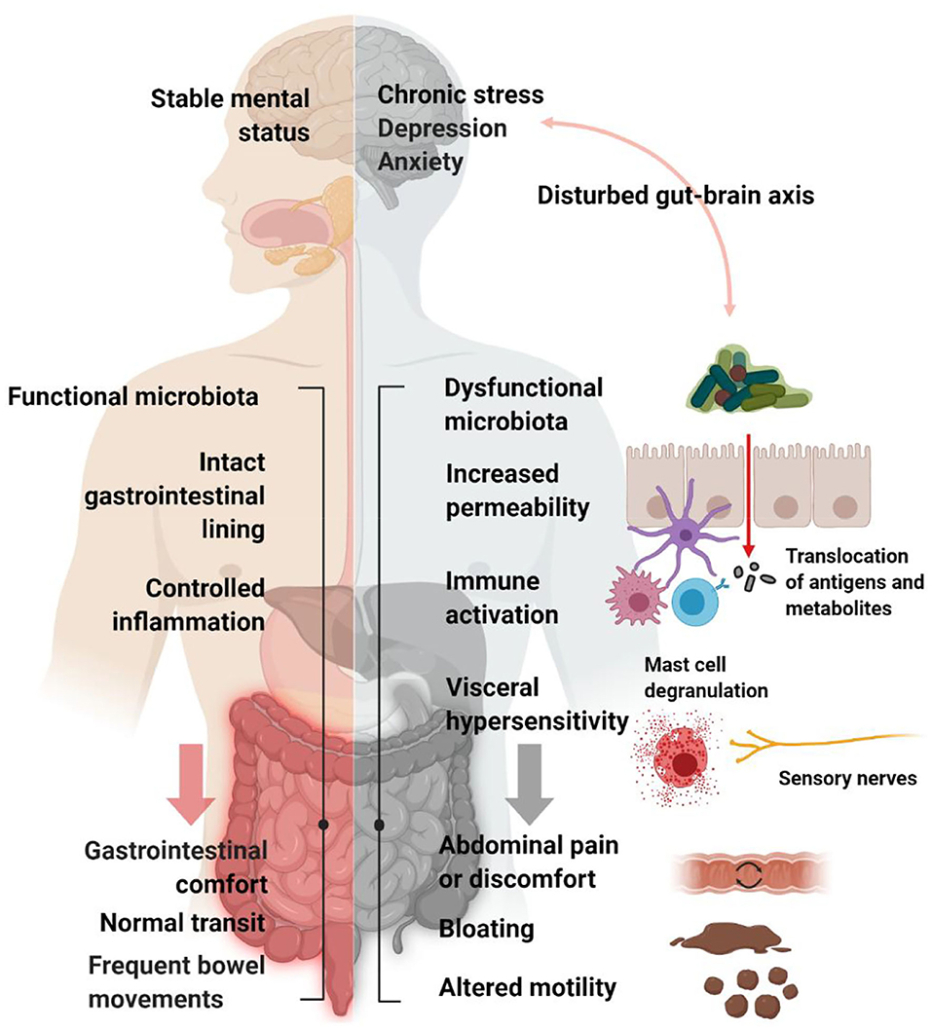 diagram of factors associated with IBS