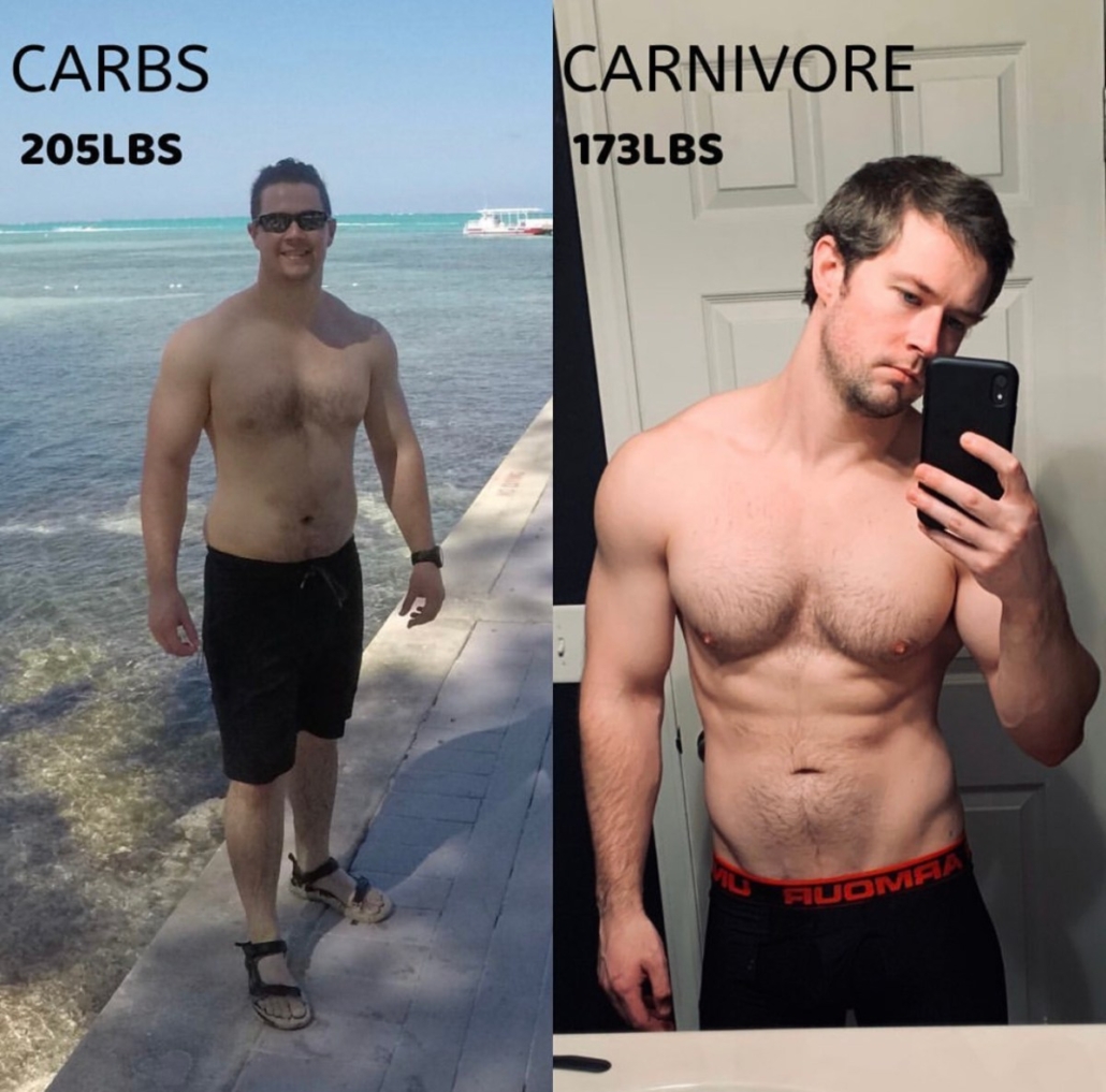 side by side carbs vs carnivore before and after pic